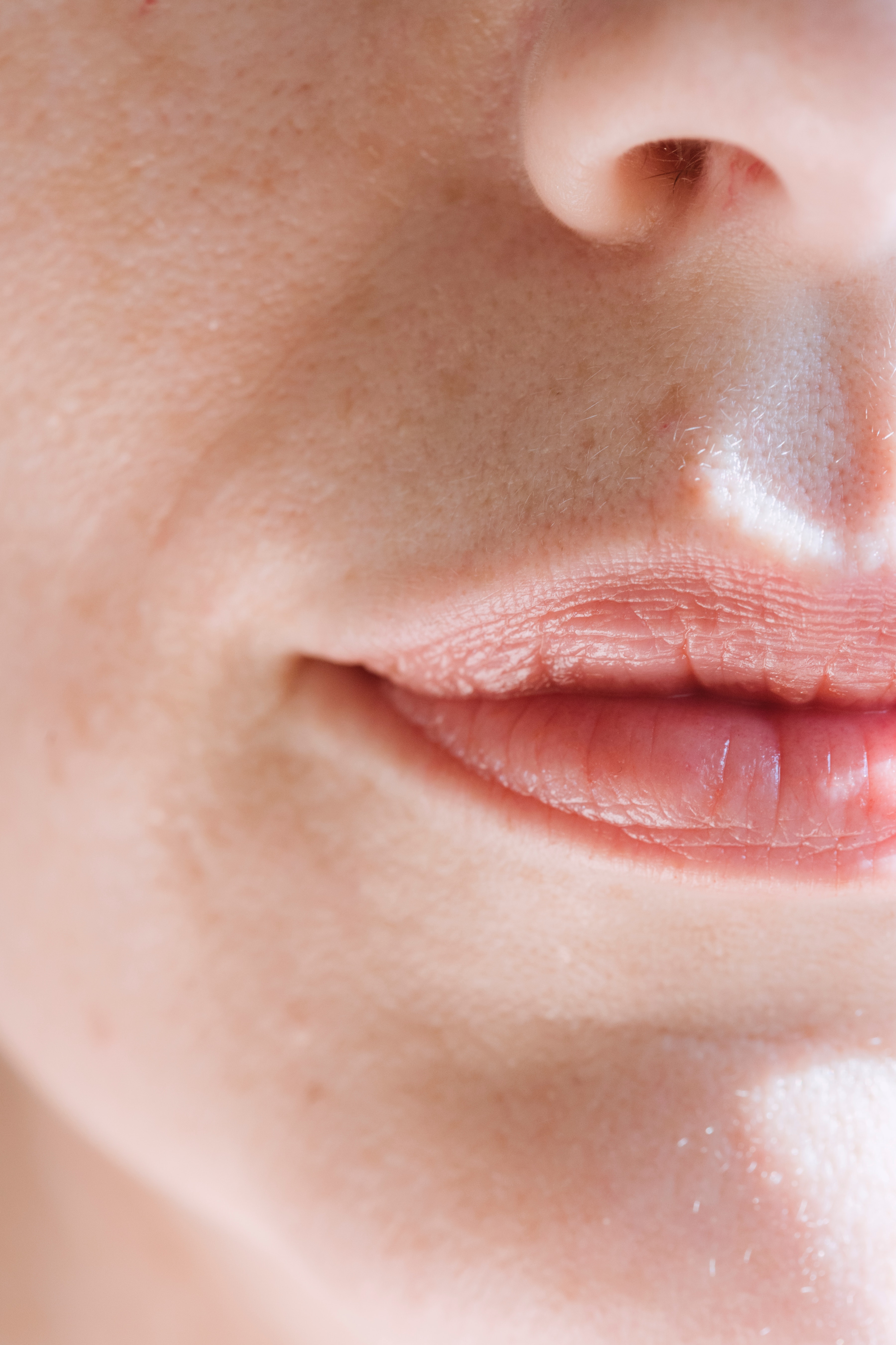 Tratamientos Naturales Para Curar El Herpes Labial Olaiz